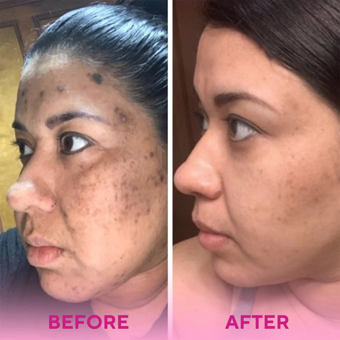 Silkeza Glow™ Turmeric & Kojic Acid Cleansing Pads