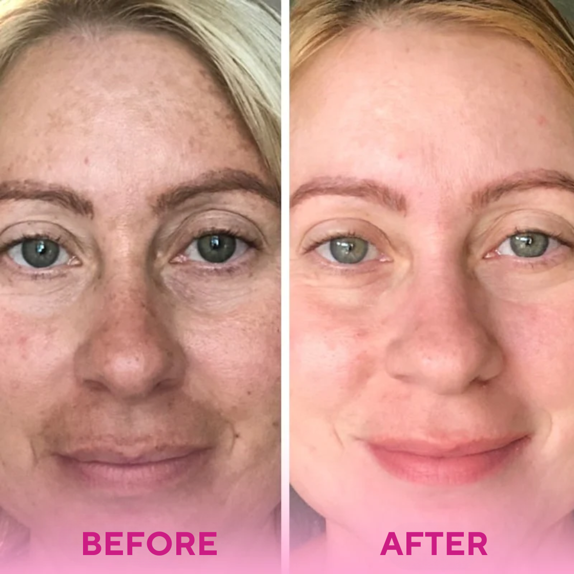 Silkeza Glow™ Turmeric & Kojic Acid Cleansing Pads