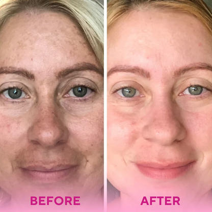 Silkeza Glow™ Turmeric & Kojic Acid Cleansing Pads